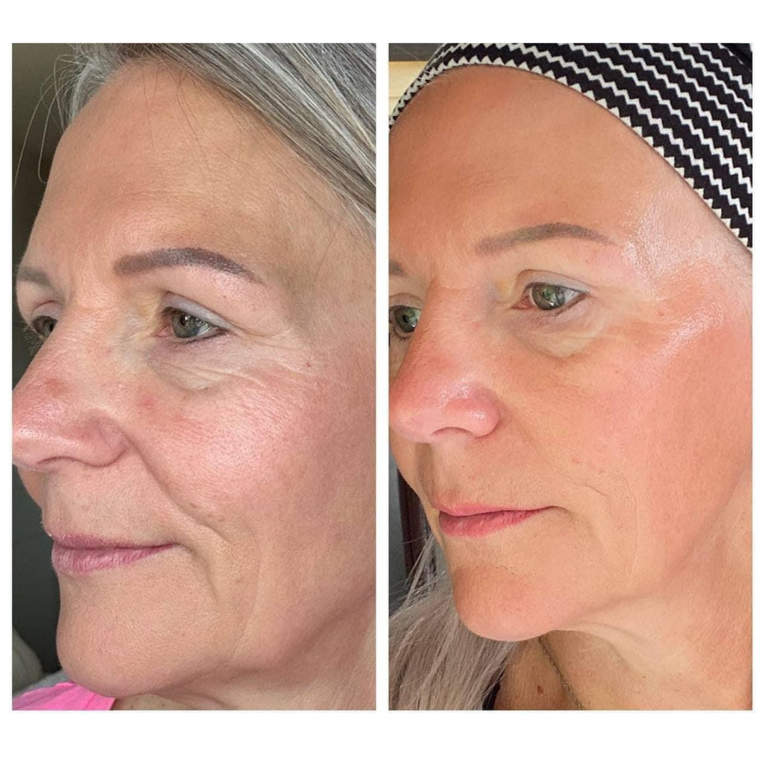Patricia M. before and after