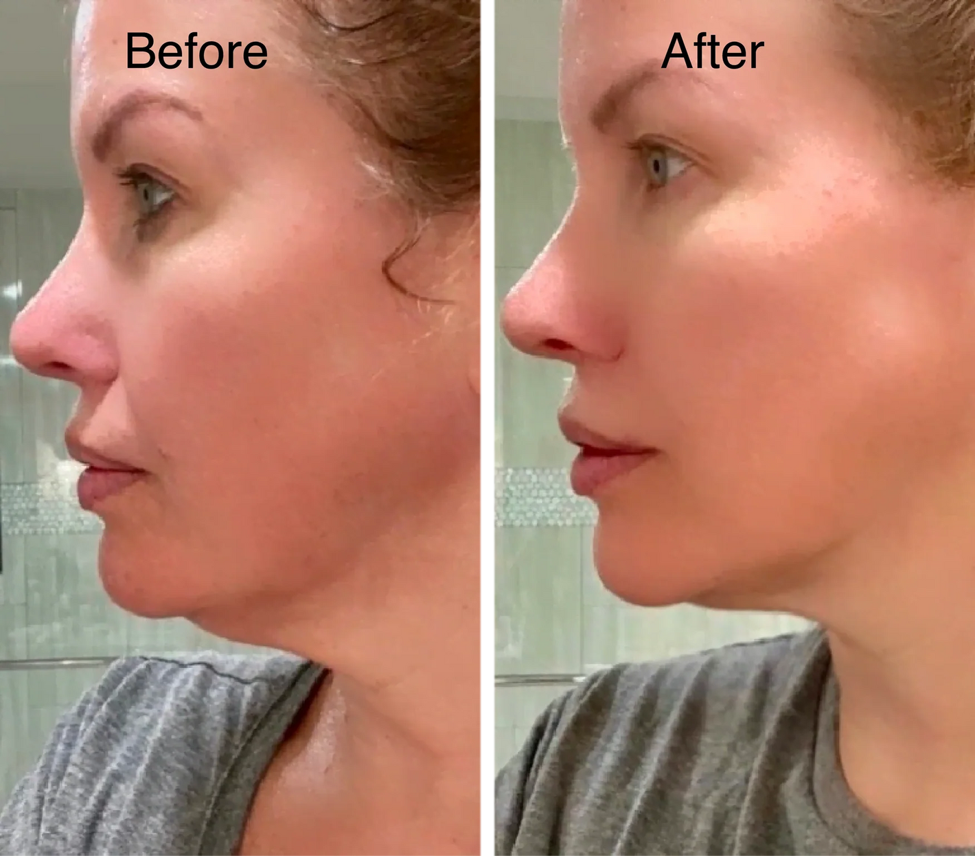 Patricia P. before and after